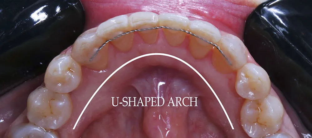 Case 01: After