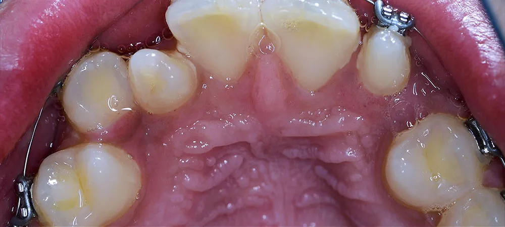 Case 03: Before