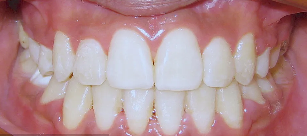 Case 04: After