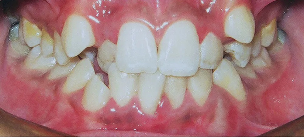 Case 04: Before