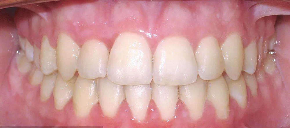 Case 05: After