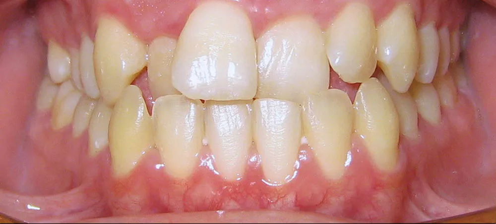 Case 05: Before