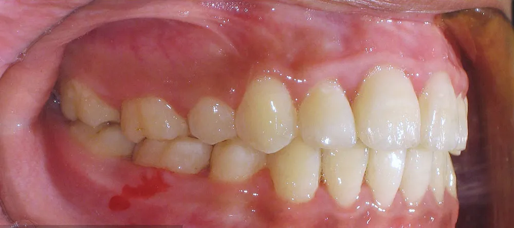 Case 06: After