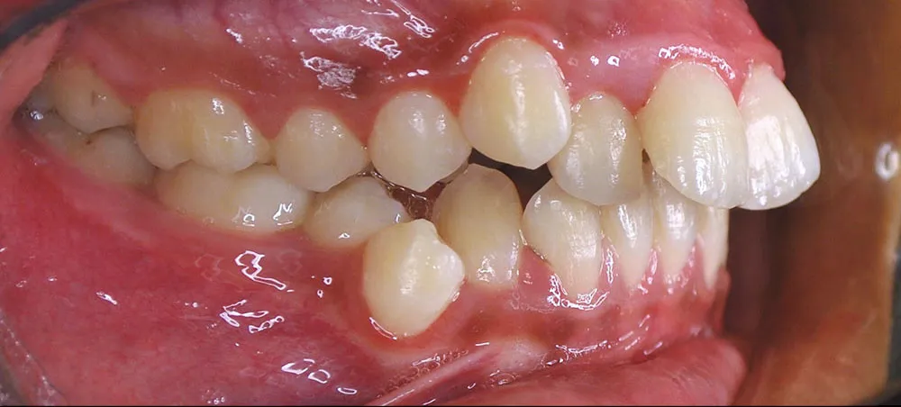 Case 06: Before