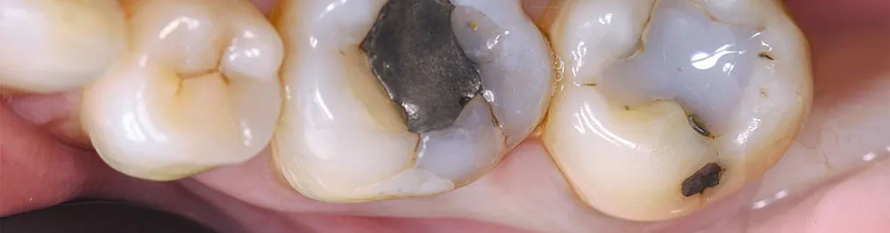 Case 07: Before