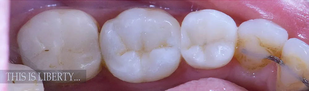 Case 08: After