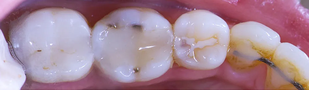 Case 08: Before