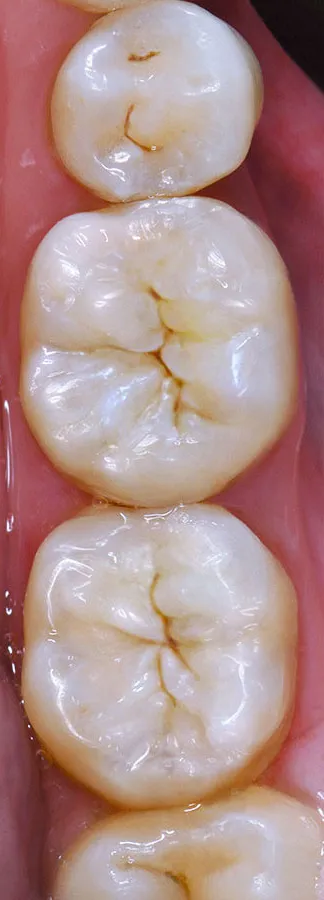 Case 09: After