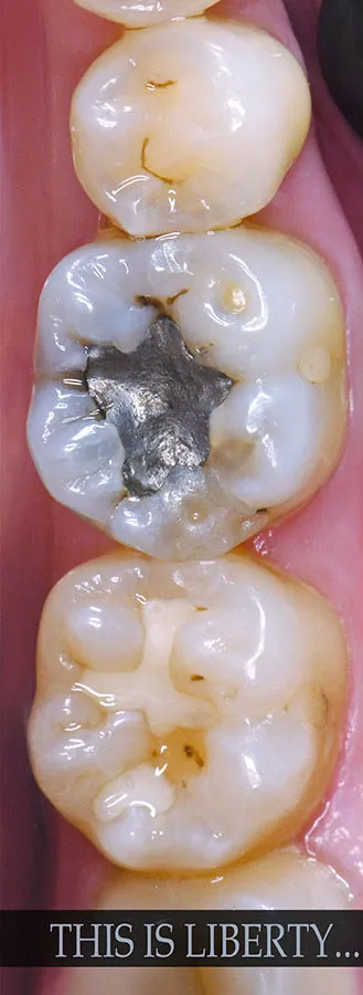 Case 09: Before