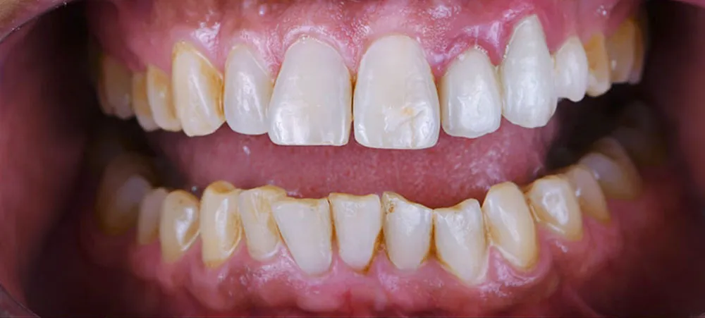 Case 10: Before
