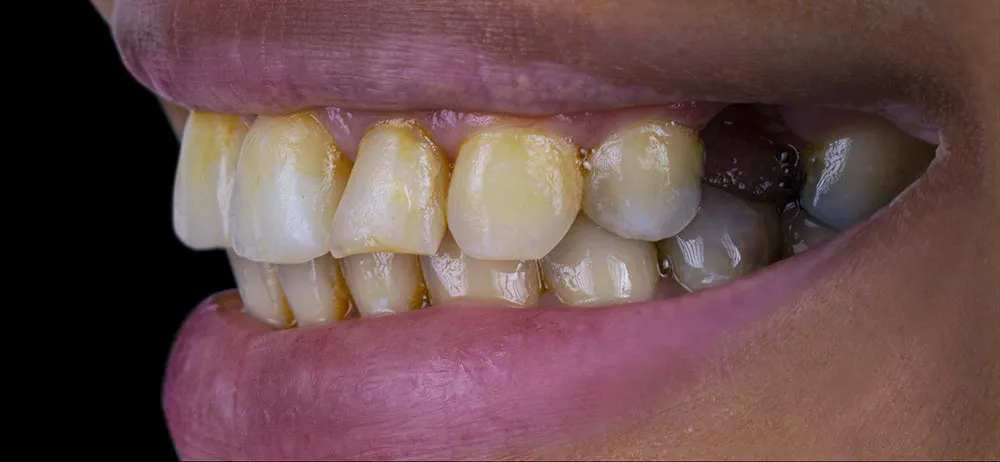 Case 12: Before
