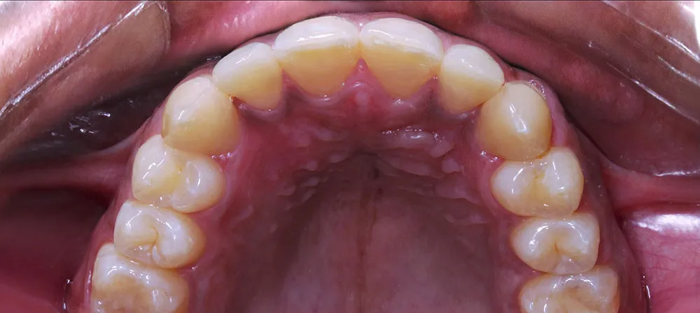 Case 16: After