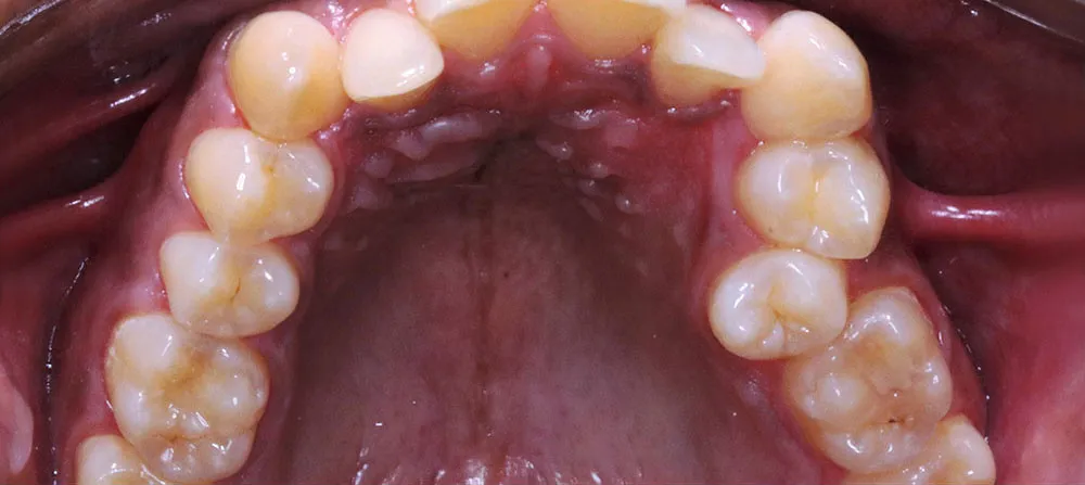 Case 16: Before