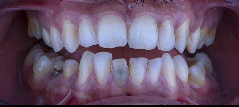 Case 17: Before
