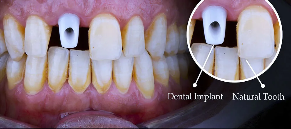 Case 18: Before