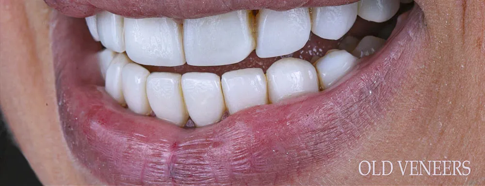 Case 19: Before
