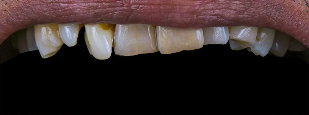 Case 20: Before