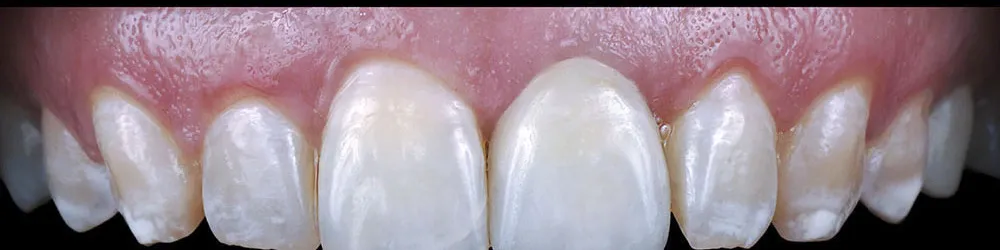 Case 21: After