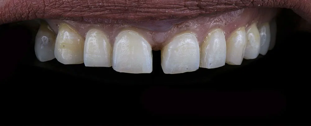 Case 22: Before