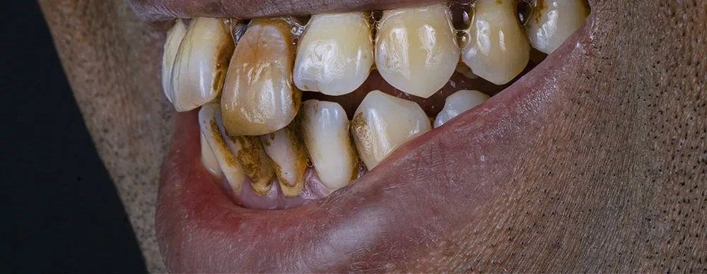 Case 23: Before