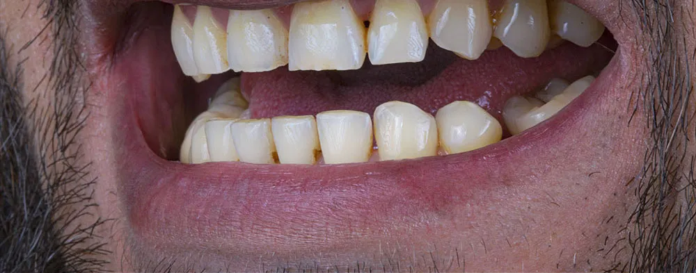 Case 24: Before