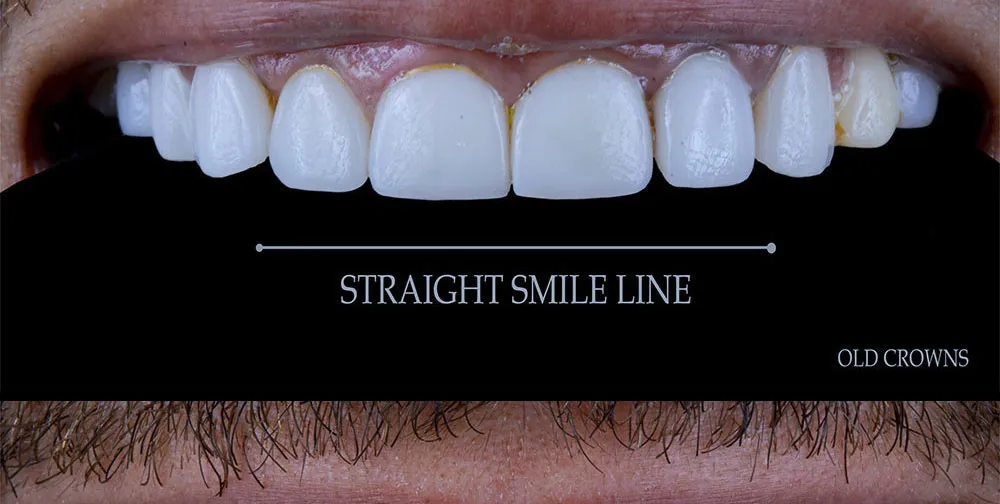 Case 25: Before