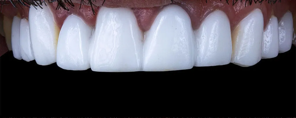 Case 26: Before