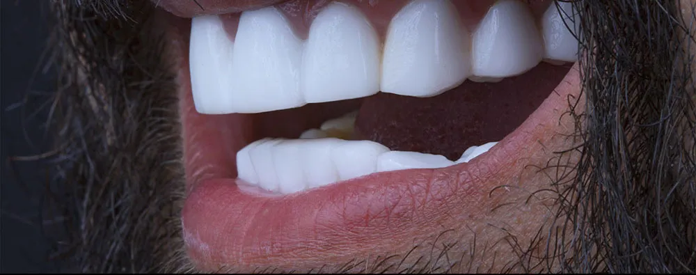 Case 27: Before