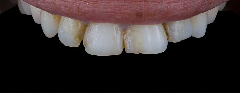 Case 28: Before