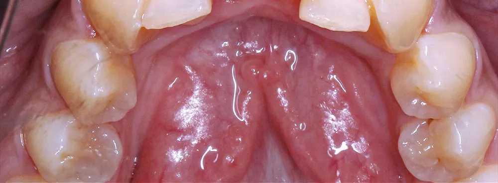 Case 29: Before