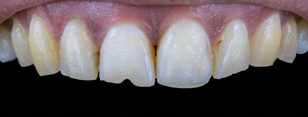 Case 30: Before