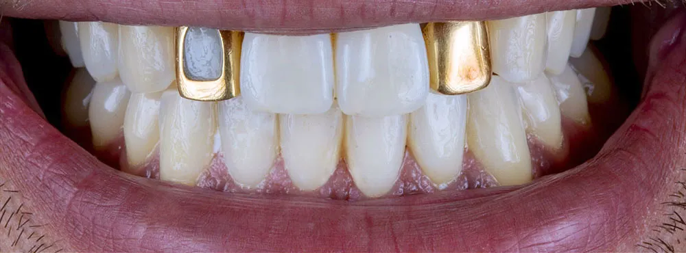 Case 31: Before
