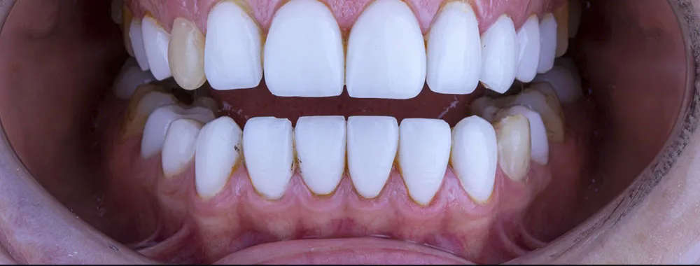 Case 32: Before