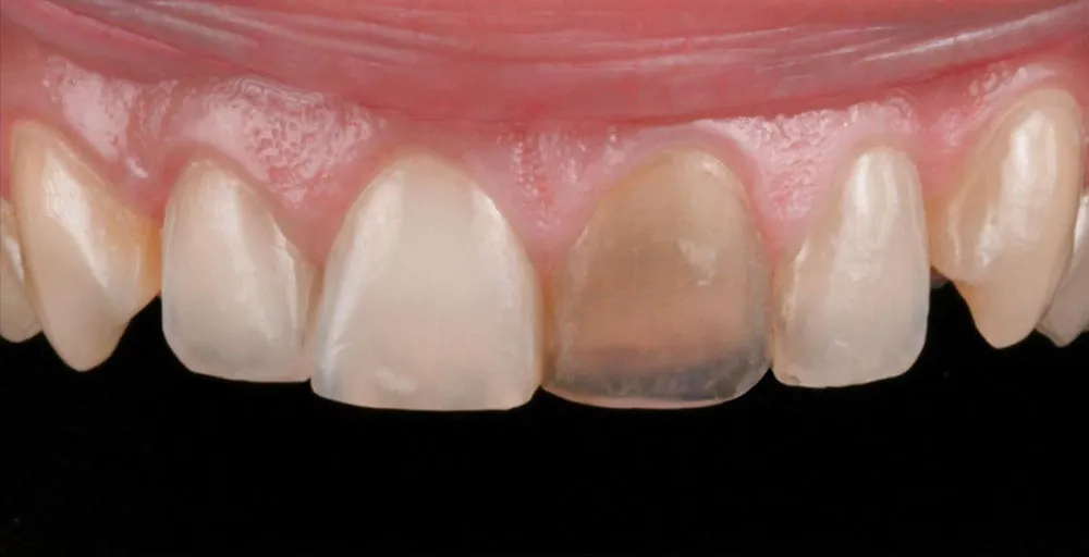 Case 35: Before