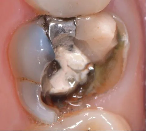 Case 36: Before