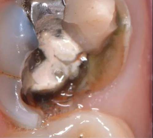 Case 37: Before